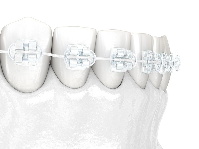 矯正歯科・小児矯正歯科